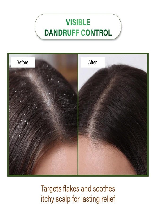 NICONI Herbal Hair Oil 200ml | - Image 3
