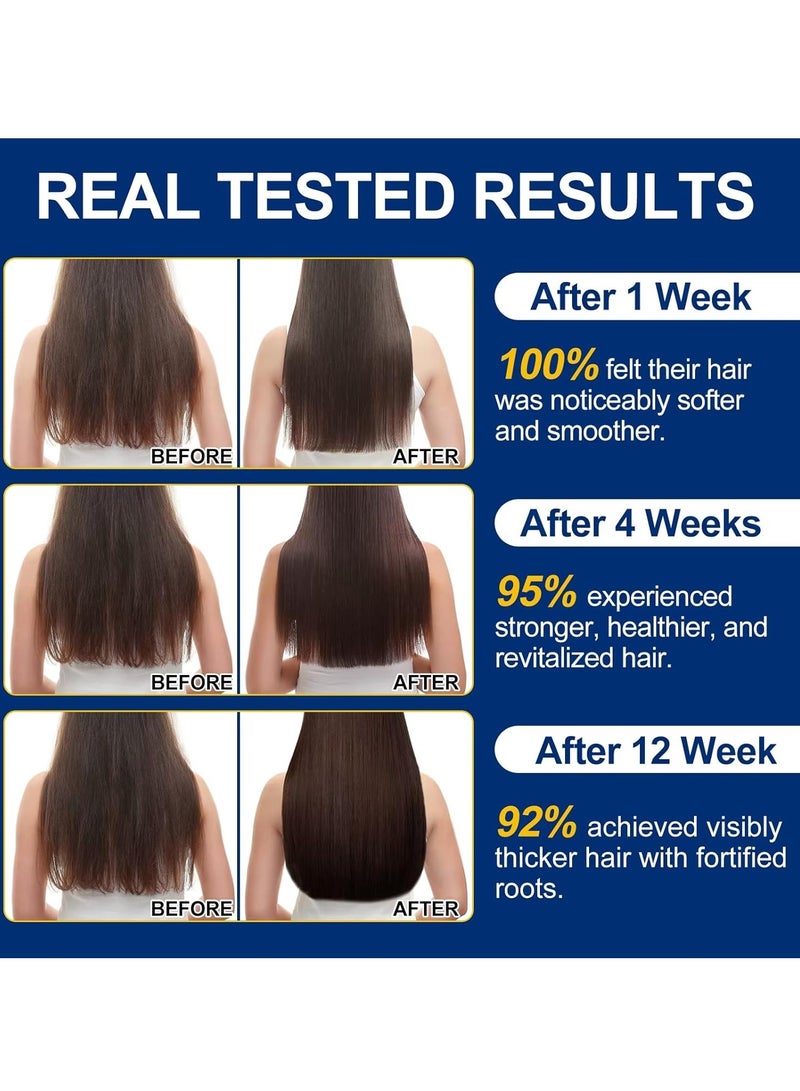 Sefudun Hair Growth Oil 60ml 3 in 1 Castor Oil with Biotin & 5% Minoxidil Hair Growth Oils Reduce Hairs Loss Nourishes Hydrating Prevent Breakage Dryness Split Ends Hairs Regrowth Serum  - Image 4