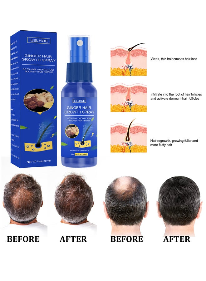 EELHOE Ginger Hair Growth Spray, Regrowth Nourishing Ginger Spray, Ginger Spray For Hair Growth, Anti Hair Loss, Thinning, Balding, Repairs Hair, Use For Hair Loss and Hair Thinning Treatment Spray 30ML - Image 5