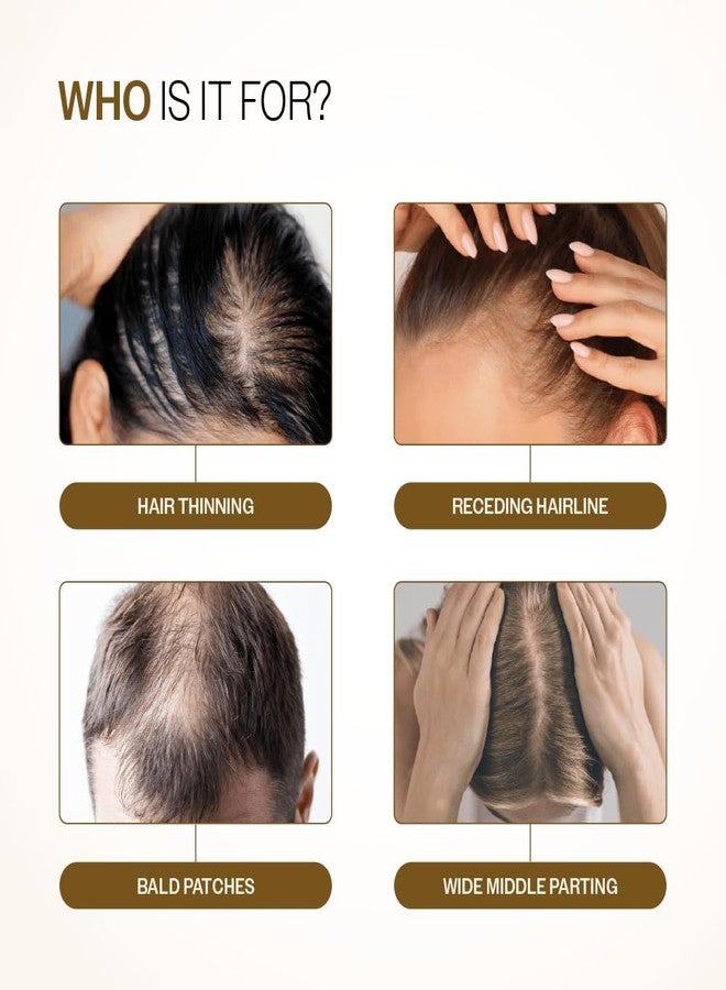بار_اناتومي رول أون متطور لزيادة كثافة الشعر من بير أناتومي | 3% ريدينسيل + 4% أناجين + 2% بايكابيل + 5% إكليل الجبل، ماء الأرز، البيوتين، والمنشارية بالميتو | يقلل تساقط الشعر، ويدعم نمو الشعر للرجال والنساء | 25 مل - Image 3