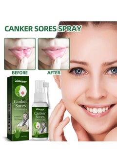 SOUTH MOON Canker Sore Treatment Spray 20ml，Herbal Ulcer Treatment,Natural Mouth Sore Relief for Daily Oral Care, Mouth Spray,Treat Mouth Ulcer,Effective Mouth Sore Treatment  - Image 1