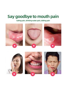 SOUTH MOON Canker Sore Treatment Spray 20ml，Herbal Ulcer Treatment,Natural Mouth Sore Relief for Daily Oral Care, Mouth Spray,Treat Mouth Ulcer,Effective Mouth Sore Treatment  - Image 2