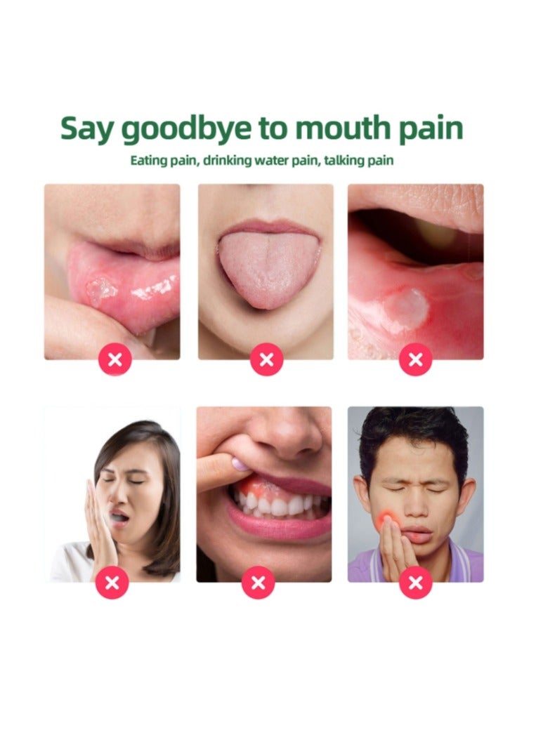 SOUTH MOON Canker Sore Treatment Spray 20ml，Herbal Ulcer Treatment,Natural Mouth Sore Relief for Daily Oral Care, Mouth Spray,Treat Mouth Ulcer,Effective Mouth Sore Treatment - Image 2