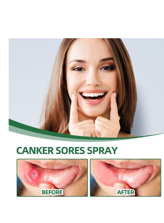 SOUTH MOON Canker Sore Treatment Spray 20ml，Herbal Ulcer Treatment,Natural Mouth Sore Relief for Daily Oral Care, Mouth Spray,Treat Mouth Ulcer,Effective Mouth Sore Treatment - Image 4