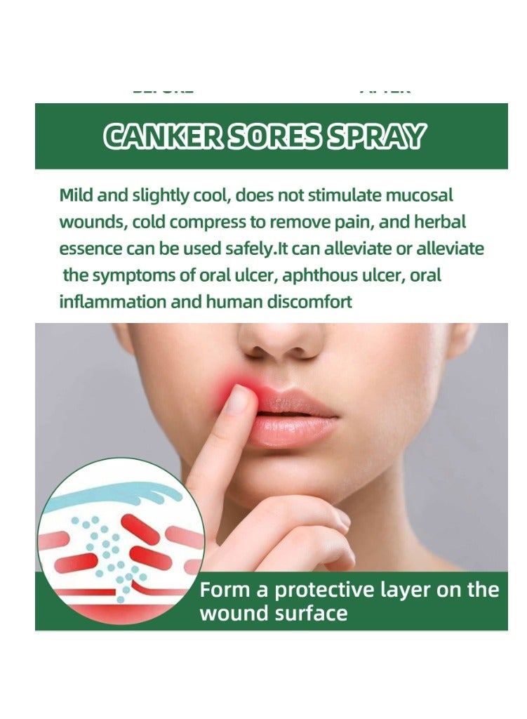 SOUTH MOON Canker Sore Treatment Spray 20ml，Herbal Ulcer Treatment,Natural Mouth Sore Relief for Daily Oral Care, Mouth Spray,Treat Mouth Ulcer,Effective Mouth Sore Treatment - Image 5