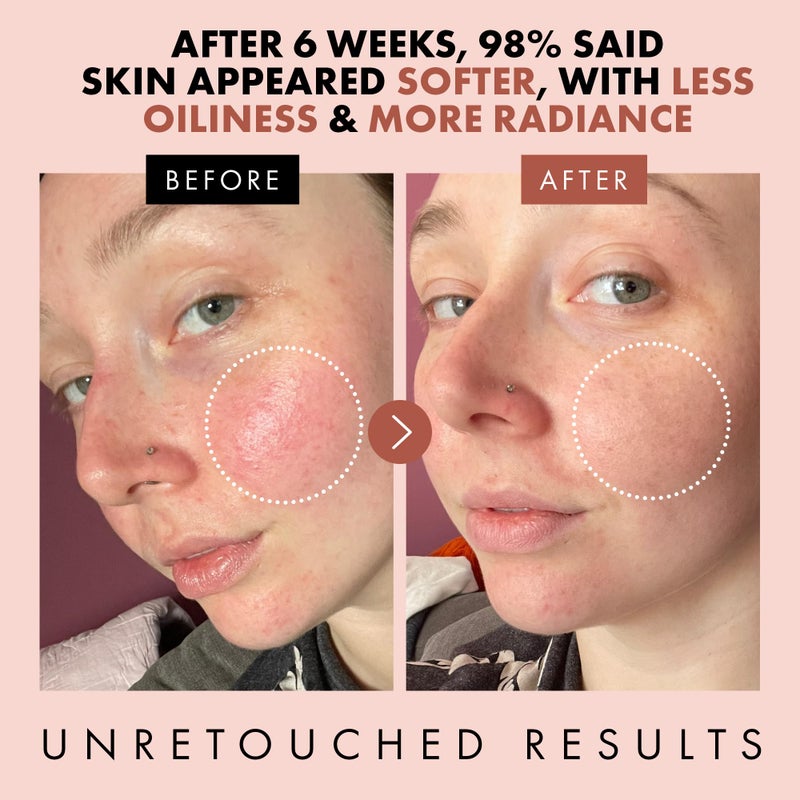 Eclat Skincare Eclat Rose Water Toner Hydrating Toner for Face - Rosewater with Hyaluronic Acid & Aloe Vera - Alcohol Free & Skin Soothing Formula - Rejuvenating & Calming Facial Skin Care - Image 3