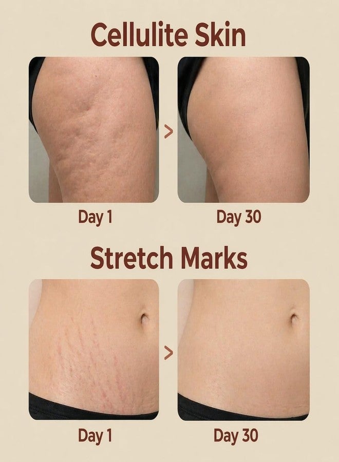 Ganrek Cellulite Cream for Belly & Thighs – Warming Sweat Gel for Workout Support, Helps Improve the Appearance of Cellulite, Body Firming Cream for Active Routines, Fast-Absorbing, 8.82 oz - Image 5