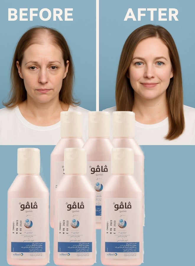 فافو 6 قطع فافو 2% شامبو 100مل - Image 1