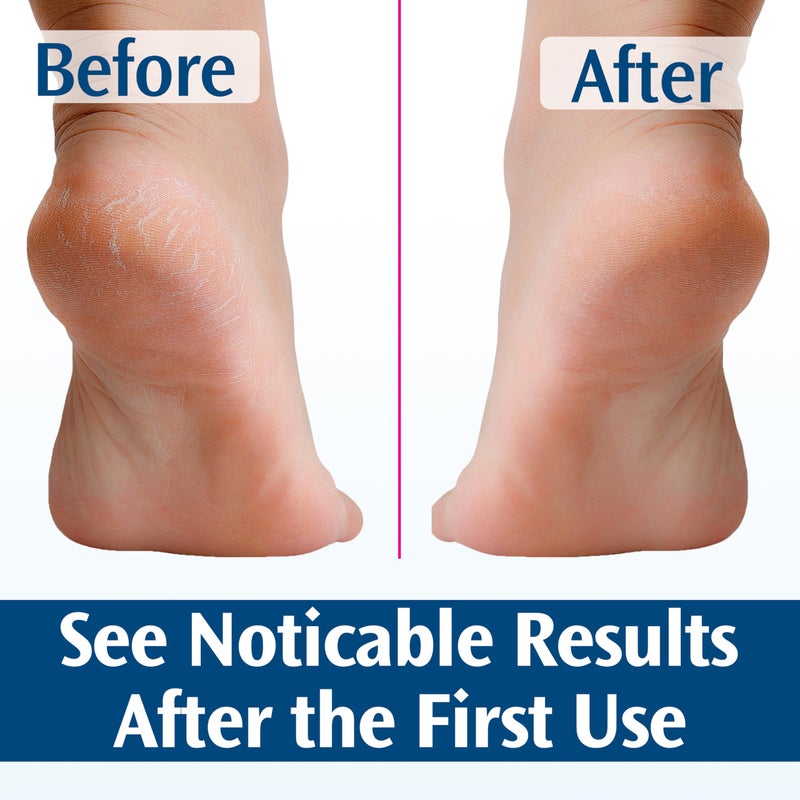 PediFix Deep-healing Foot Cream, 4 Oz - Image 4