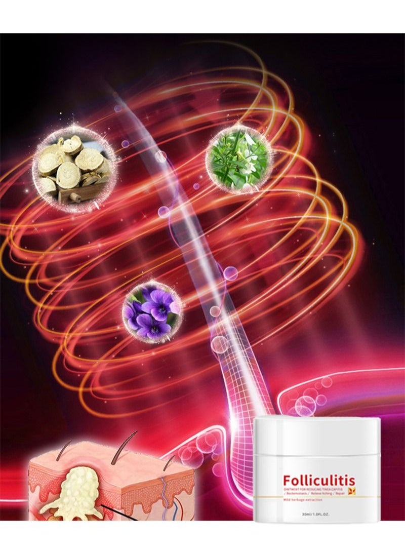 HaLunhi - Folliculitis, Folliculitis Treatment, Lichen, Folliculitis Cream, Scalp Psoriasis Treatment, Seborrheic Dermatitis Treatment, Dry Itchy Scalp Treatment, Dandruff Treatment - Safe and Fast - Image 1