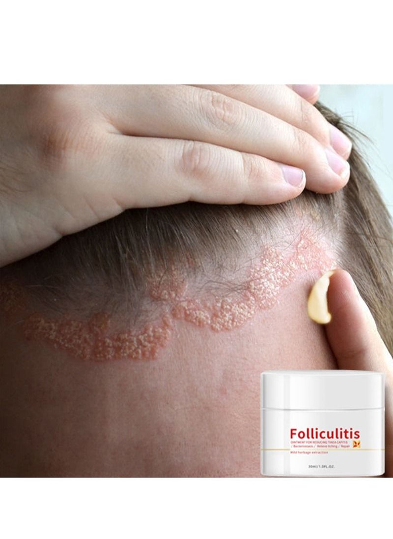 HaLunhi - Folliculitis, Folliculitis Treatment, Lichen, Folliculitis Cream, Scalp Psoriasis Treatment, Seborrheic Dermatitis Treatment, Dry Itchy Scalp Treatment, Dandruff Treatment - Safe and Fast - Image 1