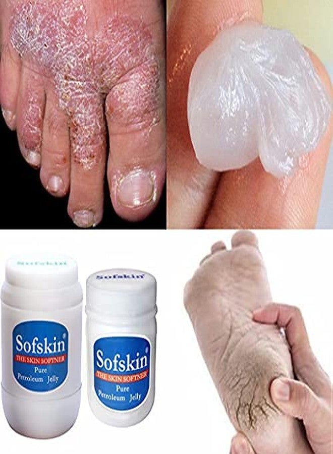 SOFSKIN (American Brand) 100% PURE WHITE PETROLEUM JELLY IP - No smell - 170 gm - Image 4