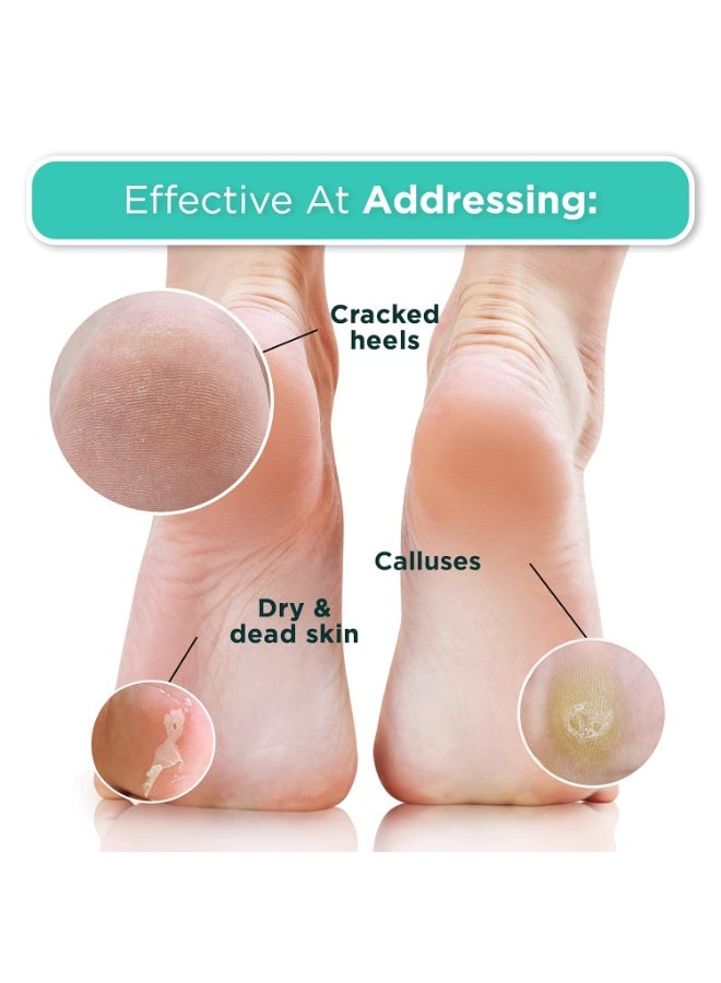 DERMORA Foot Peel Mask - 2 Pack of Regular Size Skin Exfoliating Foot Masks for Dry, Cracked Feet, Callus, Dead Skin Remover for Baby Soft Feet, Lavender Scent - Image 3