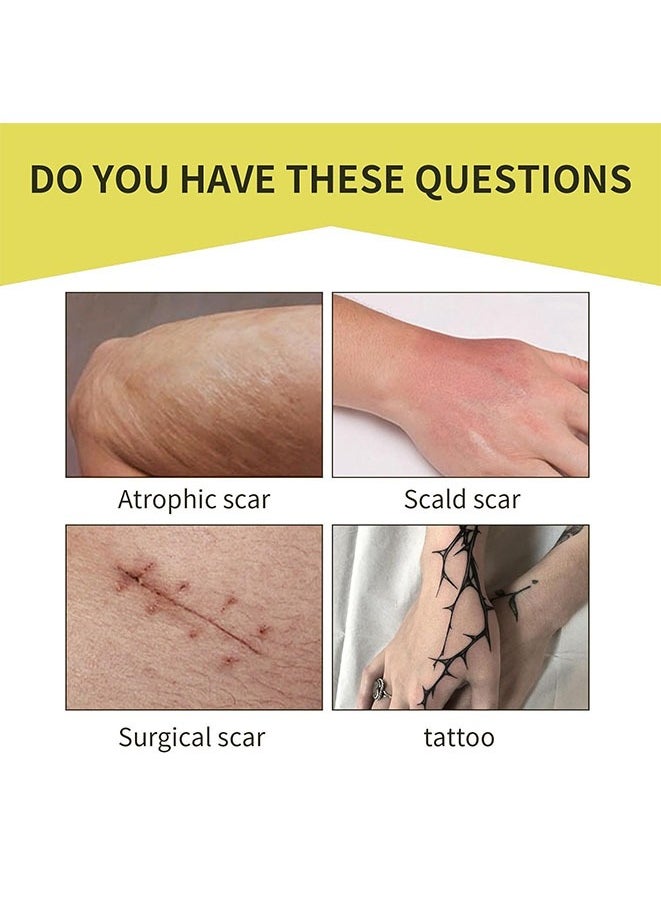 Muyixin - Tattoo Cover Up Tape, Ultra Thin Patch for Tattoo Scar and Birthmarks, Invisible Waterproof Skin Tone Concealer Sticker for Covering Up Scars Tattoos (6 Skin Primary Color) - Image 1