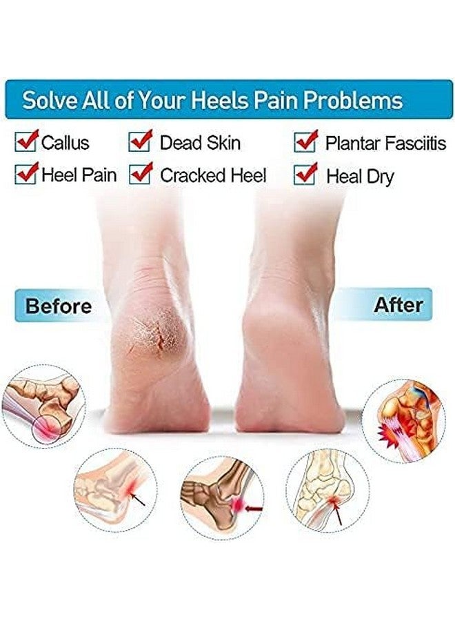 FLYWELL Moisturizing Silicone Gel Heel Pad Socks(1- Pair) Silicone Gel Heel Pad Socks For Pain Relief (2-Pair) With Heel Protector Insole Cups(1- Pair),Multicolour - Image 5