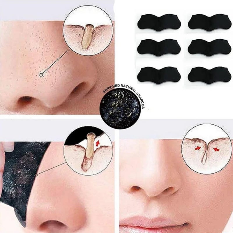 Ecogen Blackhead Remover Nose Pore Strips Set of 10 Charcoal Purifying Strips - Image 4