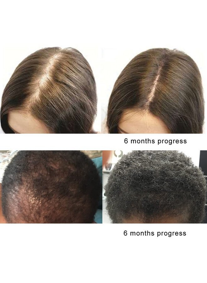 KERATIN RESEARCH The Original Pure Natural X2 Action BIOTIN DHT Blocker BETA SITOSTEROL FL Sourced Natural Wild Saw Palmetto Oil Prevents and Stops Hair Loss Strengthen Roots Promotes Urinary Flow Support Prostate  - Image 4