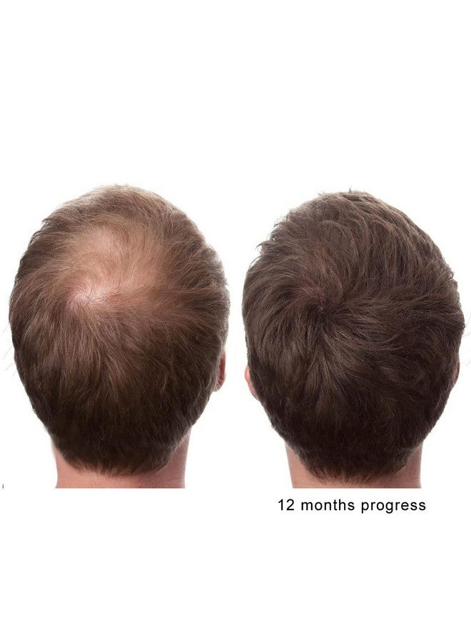 KERATIN RESEARCH The Original Pure Natural X2 Action BIOTIN DHT Blocker BETA SITOSTEROL FL Sourced Natural Wild Saw Palmetto Oil Prevents and Stops Hair Loss Strengthen Roots Promotes Urinary Flow Support Prostate  - Image 3