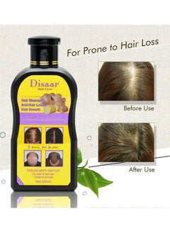 Disaar Disaar Anti Hair Loss & Hair Growth Shampoo,Oil & Derma Roller Hair Care Kit 3Pcs  - Image 5