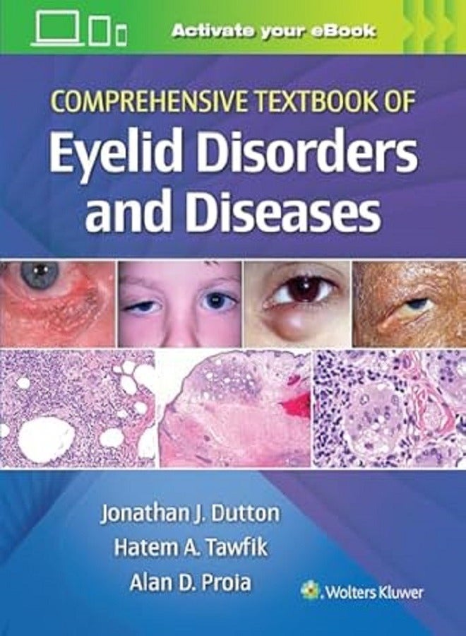 Comprehensive Textbook of Eyelid Disorders and Diseases 