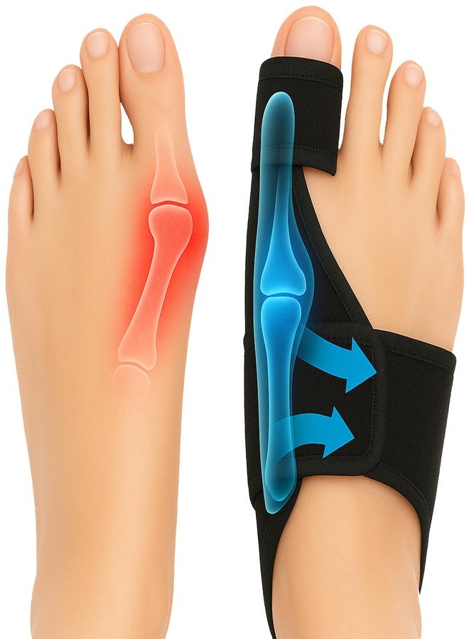 benoo Bunion Corrector for Women & Men - Image 1