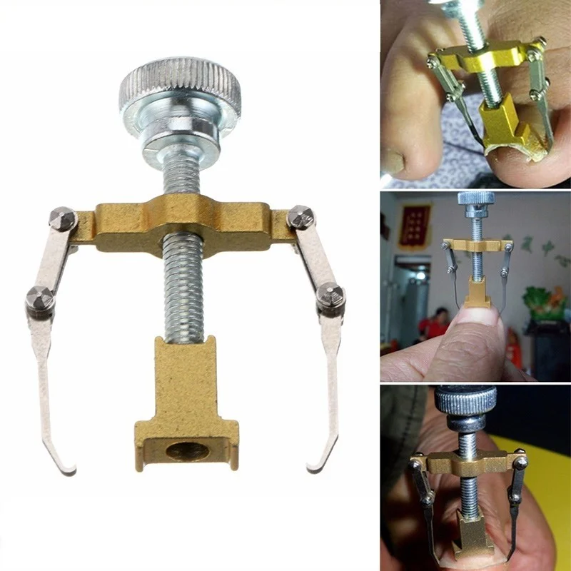 بروايثالات Professional Ingrown Nail Correction Device