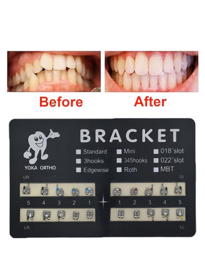 زيفانا مجموعتان من 40 قوسًا أسنانًا، قابلة للالتصاق، للجنسين، للاستخدام الداخلي، موضوع صحة الأسنان، للتثبيت على الحائط، بدون إطار، من الفولاذ المقاوم للصدأ (Mini MBT 0.22 Slot 345 Hooks) - Image 2