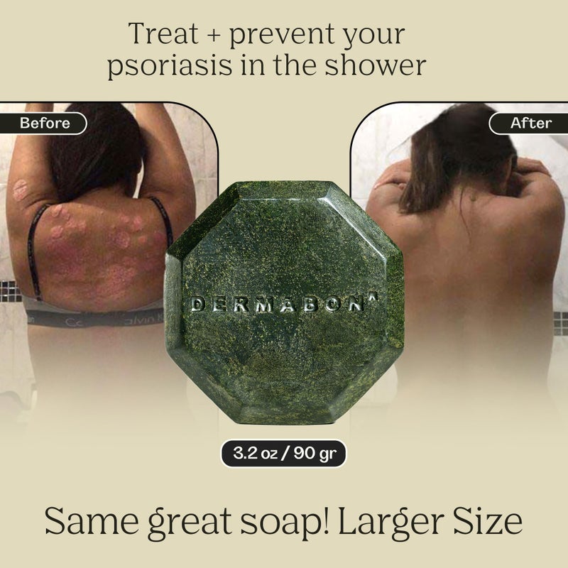 Dermabon Psoriasis, Dermatitis & Dandruff Control soap bar with 2% Coal Tar as its Active Ingredient - 1 Pack - Image 5