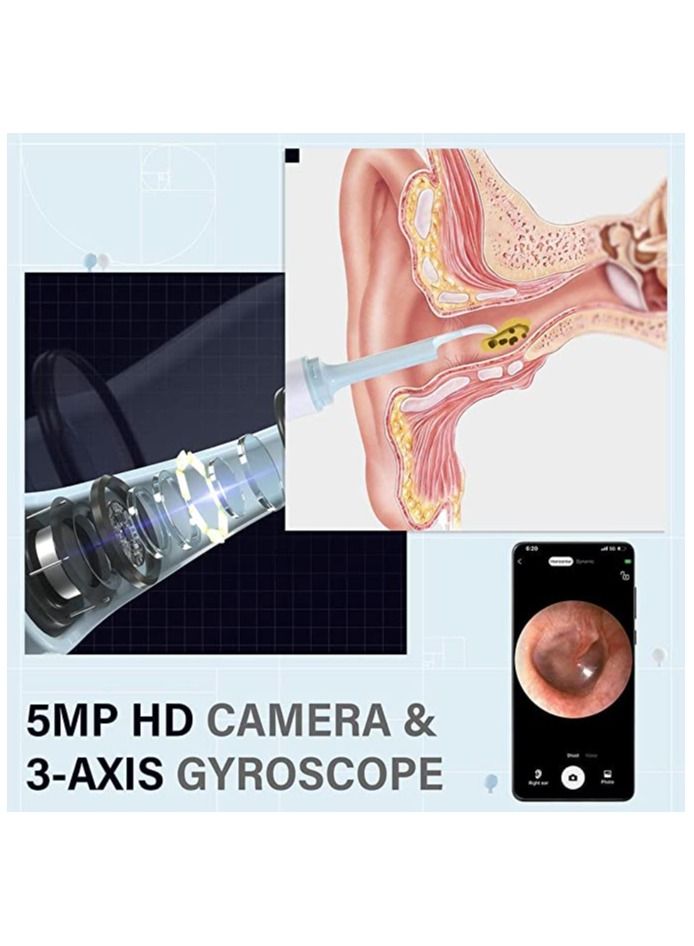 Ear Wax Removal, Ear Scope Earwax Cleaner Tool Kit, with 1080p Fhd Wireless Waterproof Ear Camera, for Iphone, Ipad and Android（white)