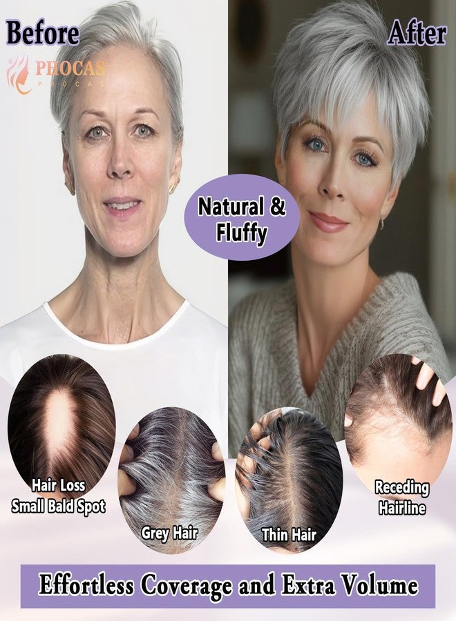 PHOCAS Short Hair Toppers for Women with Thinning Hair Magic Pixie Cut Toppers Hairpiece Natural Synthetic Grey Hair Toppers for Daily Use - Image 3