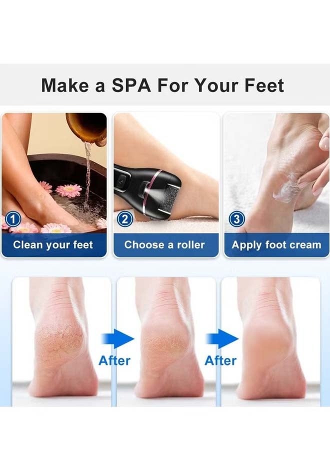 CHOWROAD Electric foot massage, 16 in 1 Callous Remover Kit for Remove Cracked Heels and Dead Skin, with 3 Roller Battery level display  - Image 3