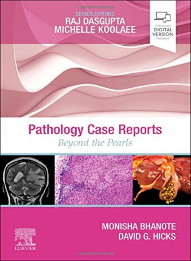 Pathology Case Reports Beyond The Pearls by Bhanote, Monisha, MD, FCAP, ABOIM (Breast Pathology Fellow, University of Rochester, Strong Memorial Paperback