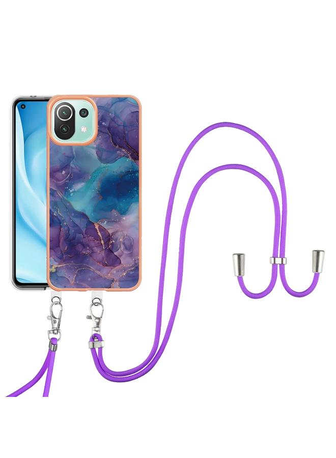 erorex Case For Xiaomi 11 Lite Electroplating Marble Dual-side IMD Phone Case with Lanyard - Image 1