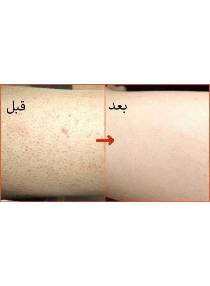 الحمام المغربي - Image 4