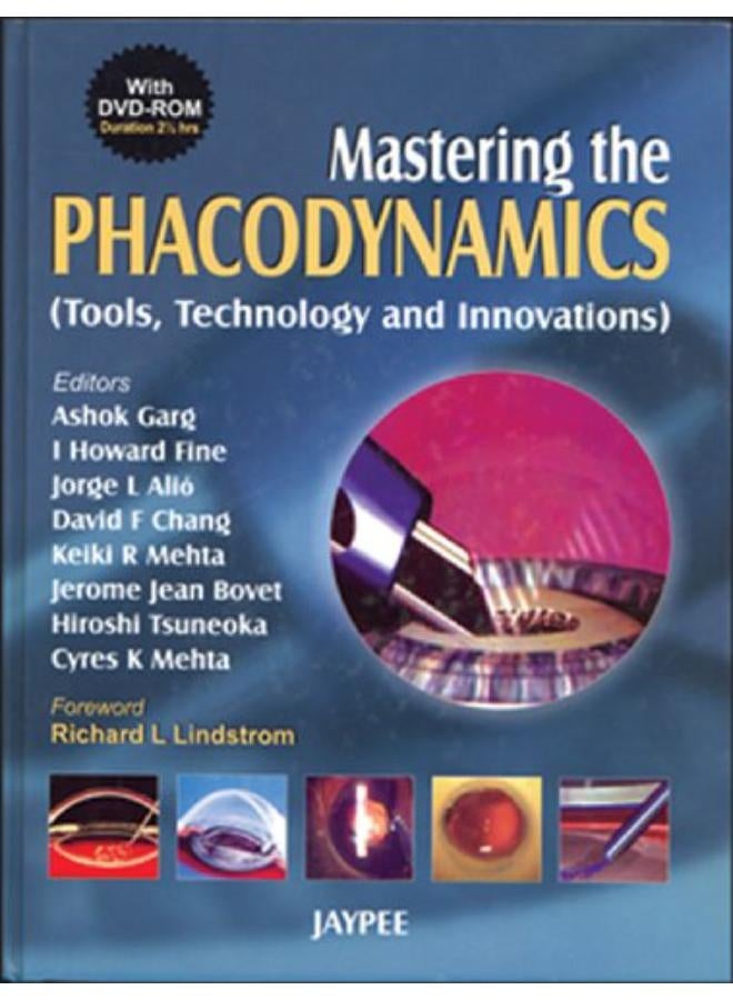 Mastering the Phacodynamics (Tools, Technology and Innovations) 