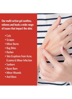 Sovereign Silver Sovereign Silver - First Aid Gel 1 Oz.  - Image 4