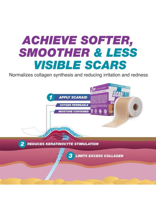 ScarAid Silicone Scar Tape – Tummy Tuck Post Surgery Supplies and Bariatric Surgery Must Haves — Superior to Vitamin E Oil for Scars — Send your Scar Away — 1 Roll 1.5” x 120” - Image 5