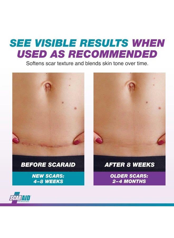 ScarAid Silicone Scar Tape – Tummy Tuck Post Surgery Supplies and Bariatric Surgery Must Haves — Superior to Vitamin E Oil for Scars — Send your Scar Away — 1 Roll 1.5” x 120” - Image 4
