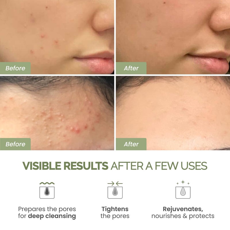 PLANTIFIQUE Korean Skincare Clay Mask â€“ Hydrating Mud Mask with Avocado & Superfoods, Dermatologist-Tested for Face & Body â€“ Vegan, 3.4 Oz/100ml - Image 2