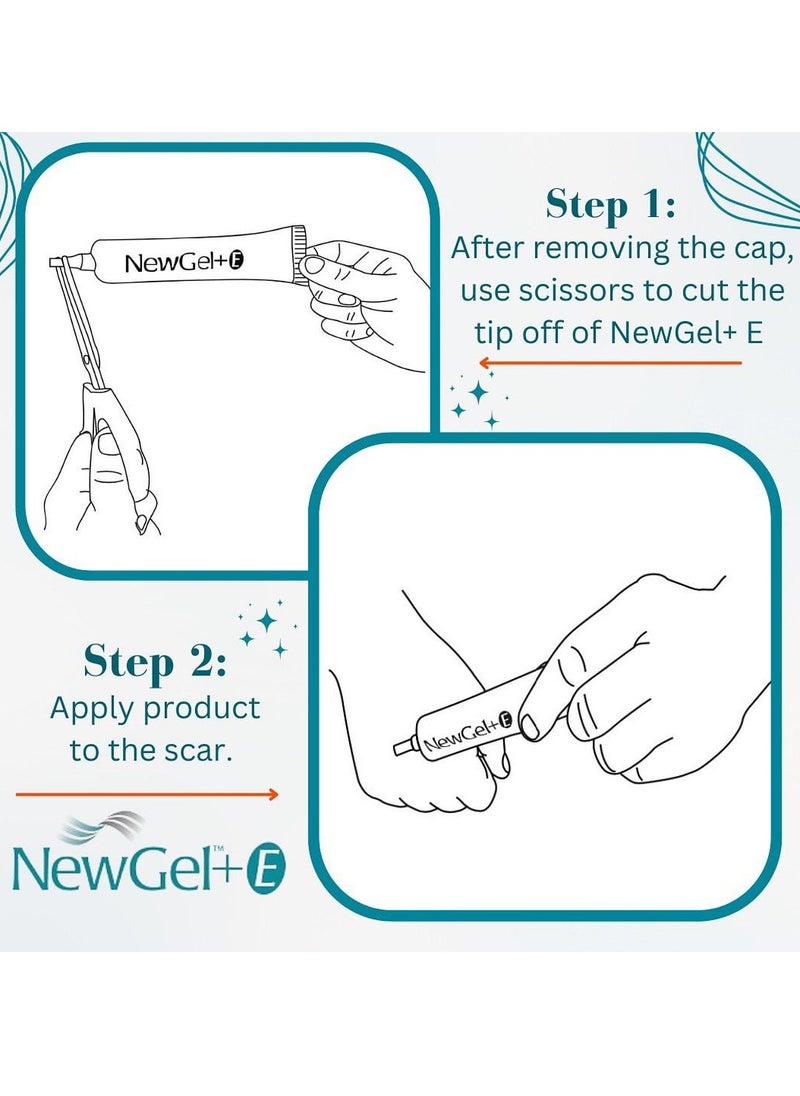 NewGel+ - Advanced Silicone Gel for Scar Treatment 30 grams - Image 1