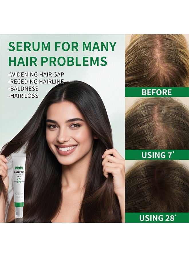 W3W Hair Growth Serum ,with Rosemary, Fermented Rice & Caffeine - Roll-On Scalp Treatment for Thinning Hair, No Minoxidil, Fast-Absorbing, Non-Greasy Formula for Women & Men,30ml - Image 4