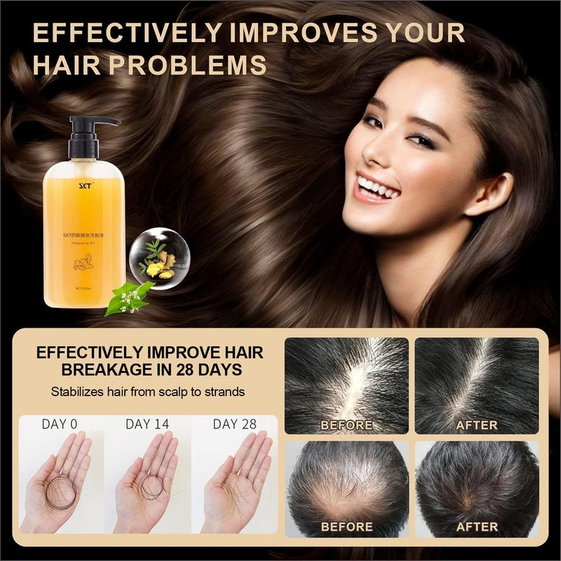SKT Ginger Plant Extract Anti Hair Loss Shampoo for Hair Regrowth, Thickening and Longer Hair - For Women & Men (400ML) - Image 4