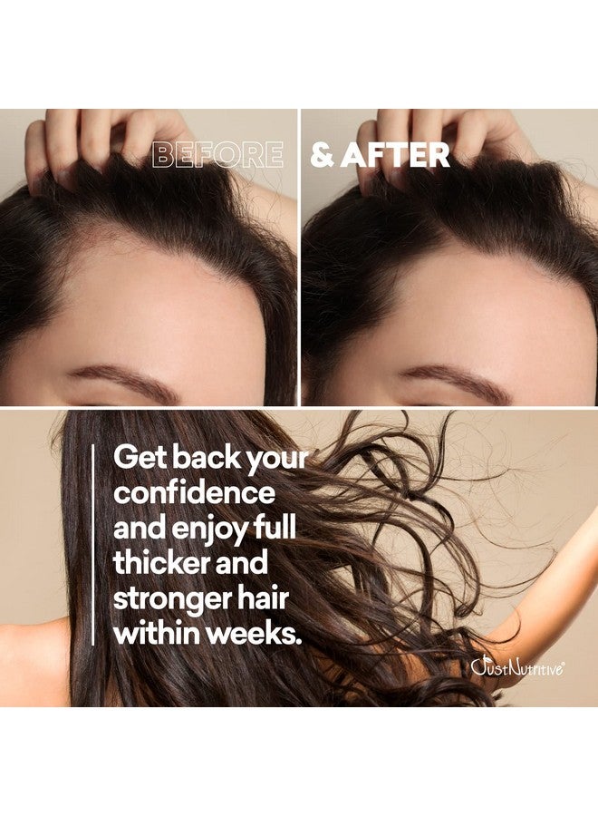 Just Nutritive Grow New Hair Shampoo ; Healthy Hair Growth ; Natural Shampoo ; For Both Men And Women ; Hair Care ; Hair Growth ; Just Nutritive ; 16 Fl Oz - Image 5
