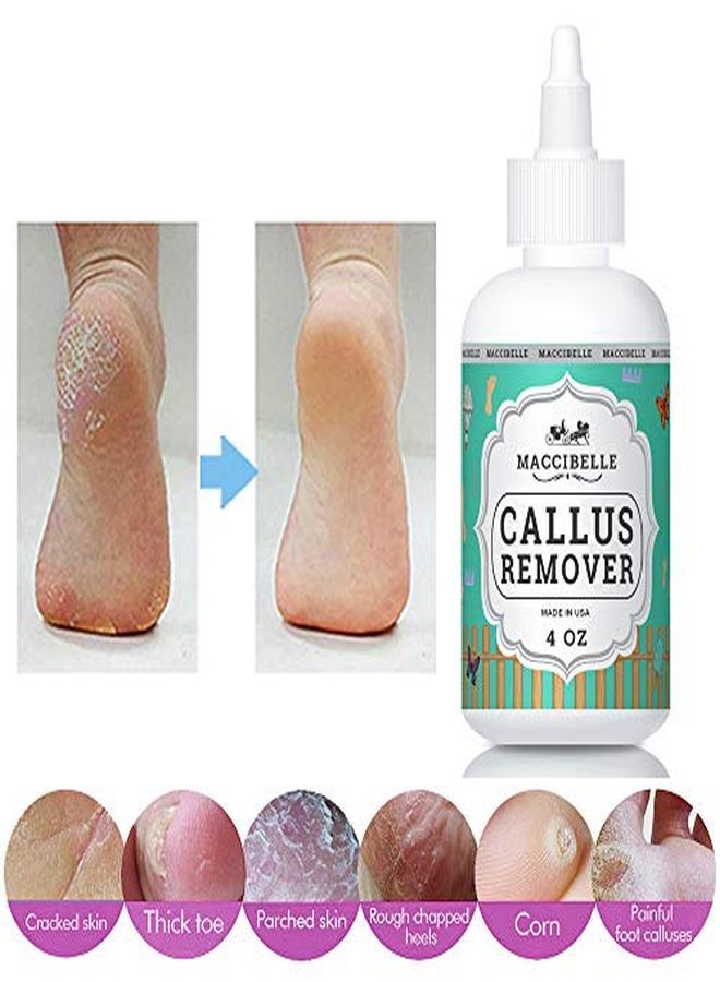 maccibelle Callus Remover Extra Strength For Feet, Professional Callus And Corn Eliminator Liquid Gel 4 Oz - Image 3