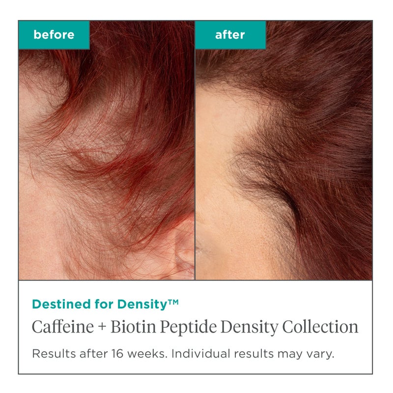 Briogeo Destined For Density Caffeine + Biotin Peptide Density Conditioner, Increases Hair Thickness and Volume for Fine or Thinning Hair, Vegan, Cruelty-Free, 8 fl oz - Image 2