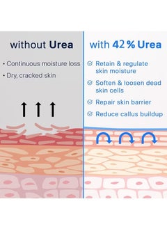 Urea Cream 42% + Salicylic Acid 2%, Foot Cream for Dry Cracked Heels Knees Elbows Hands Repair Treatment, Foot Moisturizer Corn Callus Dead Skin Remover Toenail Softener for Foot Care - pzsku/Z43C5B936DE1F946B2517Z/45/_/1739775690/54bec3a9-5f6e-4b9d-9f81-35b4317e2993