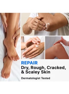 Urea Cream 42% + Salicylic Acid 2%, Foot Cream for Dry Cracked Heels Knees Elbows Hands Repair Treatment, Foot Moisturizer Corn Callus Dead Skin Remover Toenail Softener for Foot Care - pzsku/Z43C5B936DE1F946B2517Z/45/_/1739775692/a4641227-1d30-4120-ab3e-2db2213bcd22