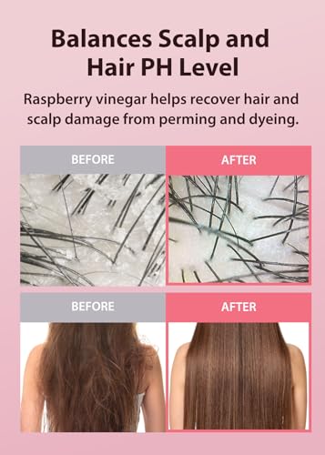 A'Pieu A’PIEU Raspberry Vinegar Hair Shampoo - Dandruff & Clarifying Shampoo with Scalp Treatment. Balances pH, Removes Buildup, Soothes Scalp. Korean Hair Care. 16.9 fl.oz - Image 5