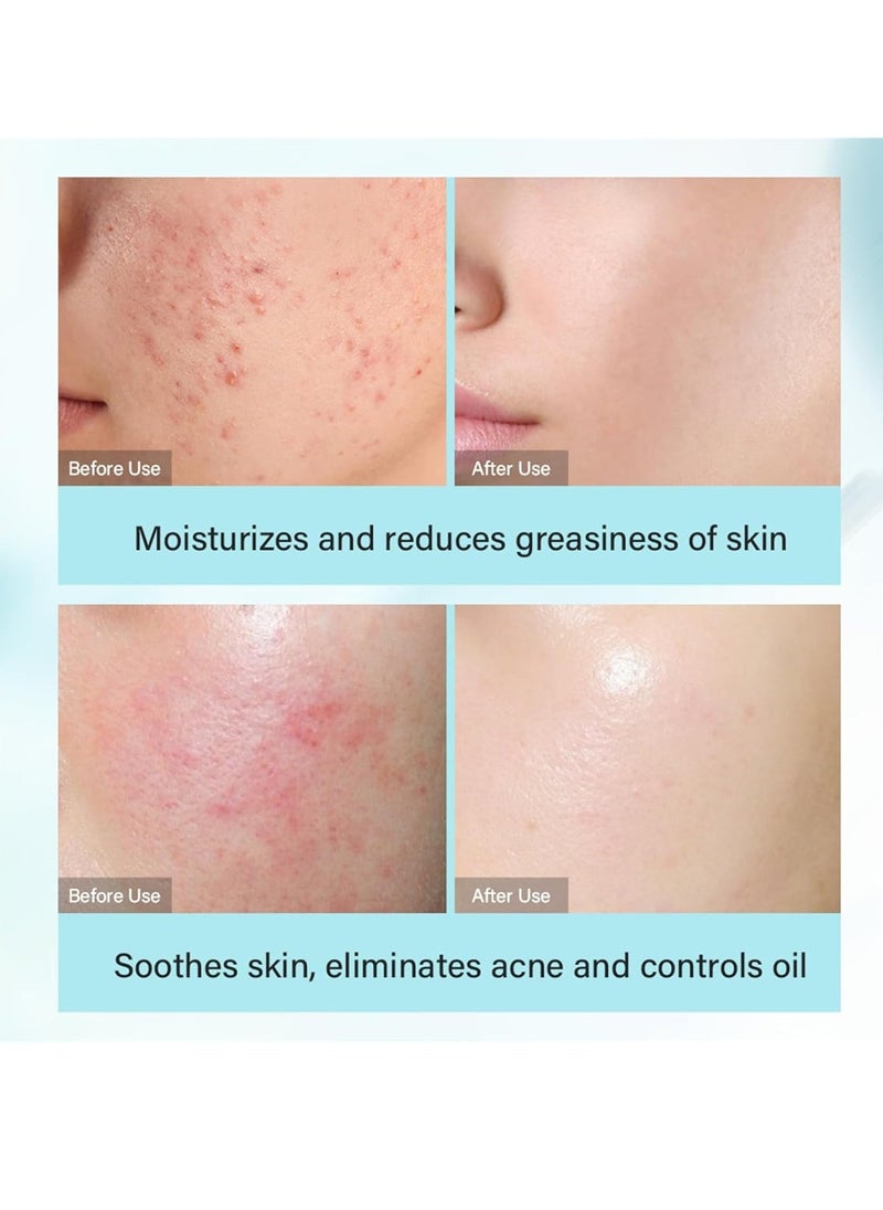 MOIKA مجموعة العناية بالبشرة بالشاي الأخضر، مجموعة هدايا العناية بالبشرة 4 في 1 للفتيات المراهقات، مجموعة العناية بالبشرة الكورية مع حمض الساليسيليك، سيروم، تونر، كريم وجه، منظف، مجموعة العناية بالبشرة للمراهقات للتحكم في الزيت والترطيب - Image 3