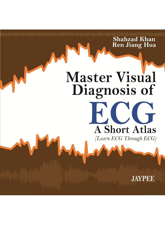 Master Visual Diagnosis of Ecg: A Short Atlas (Learn ECG Through Ecg) 